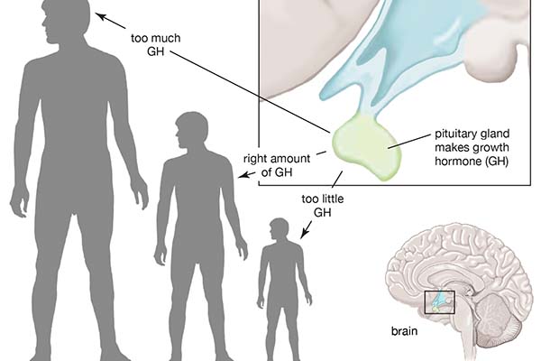 Best tips for you to boost Growth Hormone naturally