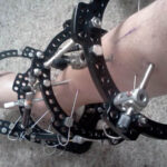 Grow taller surgery – Cost and side effects